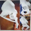 [Bonesmart.org] Complex surgery with revisions, infection, sepsis, and more…