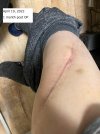 [Bonesmart.org] Lateral pelvic tilt and real LLD (7mm)