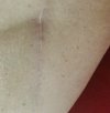 [Bonesmart.org] Weird sensations and feeling of instability at times