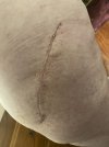 [Bonesmart.org] Hippies scars - post your badges of honor here: NO CHIT-CHAT HERE PLEASE