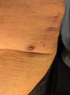 [Bonesmart.org] SelfHelp's recovery Thread