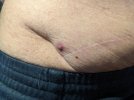 [Bonesmart.org] SelfHelp's recovery Thread