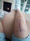 [Bonesmart.org] Recovery #2