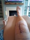 [Bonesmart.org] Recovery #2