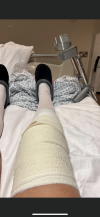[Bonesmart.org] Popliteus tendon