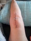[Bonesmart.org] Recovery #2