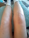 [Bonesmart.org] Recovery #2