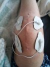 [Bonesmart.org] Recovery #2