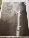 [Bonesmart.org] Partial Revision Failure