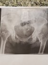 [Bonesmart.org] Partial Revision Failure