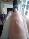 [Bonesmart.org] Recovery #2