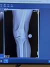 [Bonesmart.org] Adieu
