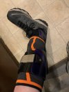 [Bonesmart.org] First TKR and now Spinal Fusion