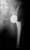 [Bonesmart.org] Recovery---Ups and Downs to be Expected?