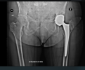 [Bonesmart.org] Recovery---Ups and Downs to be Expected?
