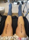 [Bonesmart.org] Knee Scars - Post Your Badges of Honor Here! NO CHIT-CHAT please