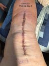 [Bonesmart.org] My Journey