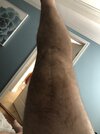 [Bonesmart.org] Knee Scars - Post Your Badges of Honor Here! NO CHIT-CHAT please