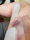 [Bonesmart.org] Partial Revision Failure