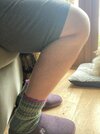 [Bonesmart.org] Two TKRs and a broken kneecap - on the mend now!