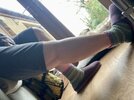 [Bonesmart.org] Two TKRs and a broken kneecap - on the mend now!