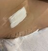 [Bonesmart.org] Hippies scars - post your badges of honor here: NO CHIT-CHAT HERE PLEASE