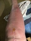 [Bonesmart.org] My Journey
