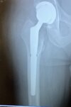 [Bonesmart.org] Second times a charm?