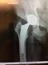 [Bonesmart.org] Second times a charm?