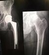 [Bonesmart.org] Time to change things up.