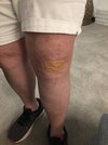 [Bonesmart.org] Suggestions needed for “tight band” feeling