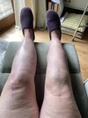 [Bonesmart.org] Two TKRs and a broken kneecap - on the mend now!