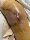 [Bonesmart.org] Revision #3 Journey