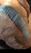 [Bonesmart.org] Hippies scars - post your badges of honor here: NO CHIT-CHAT HERE PLEASE