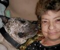 [Bonesmart.org] Complex surgery with revisions, infection, sepsis, and more…