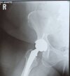 [Bonesmart.org] Mature Mama has her RTHR and 4th joint!
