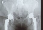 [Bonesmart.org] Mature Mama has her RTHR and 4th joint!