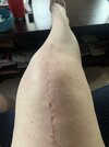 [Bonesmart.org] Knee Scars - Post Your Badges of Honor Here! NO CHIT-CHAT please