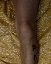 [Bonesmart.org] PoorlyKnees’ road to recovery