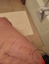 [Bonesmart.org] Laura's THR - Tight Knee on Op Side