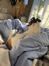 [Bonesmart.org] Patellofemoral PKR with Ehlers Danlos hypermobility