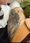 [Bonesmart.org] Hippies scars - post your badges of honor here: NO CHIT-CHAT HERE PLEASE