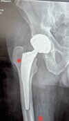 [Bonesmart.org] Quad pain