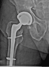 [Bonesmart.org] Quad pain