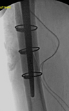 [Bonesmart.org] Quad pain