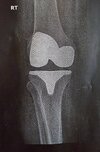 [Bonesmart.org] Moving forward.