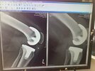 [Bonesmart.org] Getting somewhere at last!