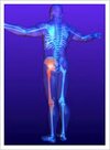 [Bonesmart.org] On road to recovery
