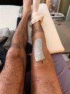 [Bonesmart.org] PKR Recovery & Rehab