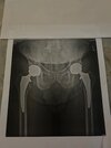 [Bonesmart.org] AMAB’s LHR Completes a Full Set